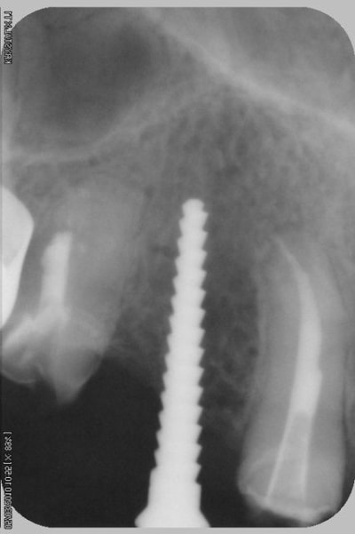 051 d0tumr - Eugenol