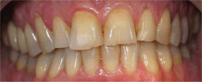 05 oim volontaire cfy1aw - Eugenol