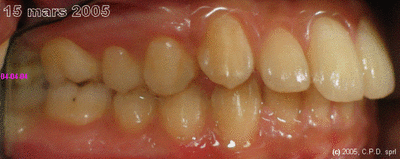 05g 4mars05 y2zqst - Eugenol