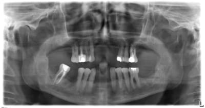 06 09 11 lsecqg - Eugenol