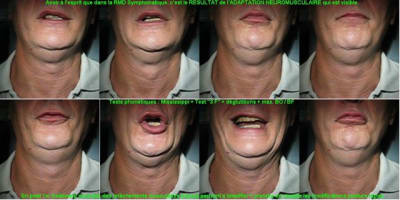 08 adaptations phonetiques j1qglw - Eugenol