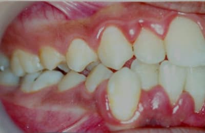 10 03 04 pd bidmzl - Eugenol