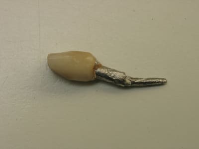 100406 001 imtfb4 - Eugenol