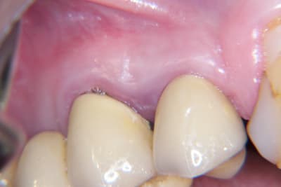 100 0656 vquwk3 - Eugenol