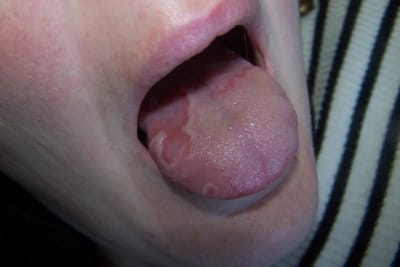 100 1322 tntgyd - Eugenol