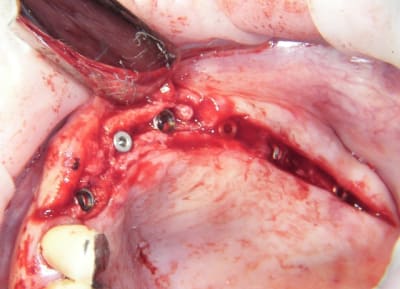 100 5397 ilqpka - Eugenol