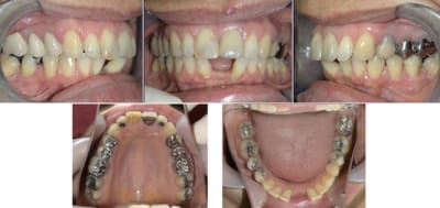 10994 0 kr7c71 - Eugenol