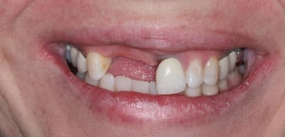 11 12 3 rttbzm - Eugenol