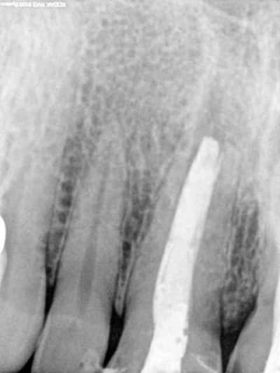 11  pkyh4n - Eugenol
