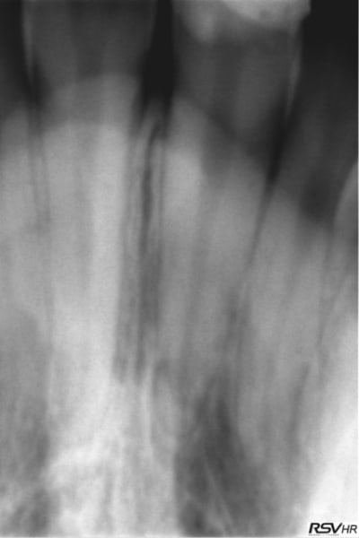 11 fract  qhggr5 - Eugenol