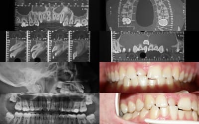 11bis jym6uq - Eugenol