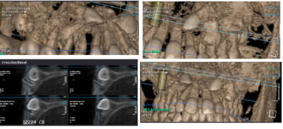 12224 cbct mqedtb - Eugenol