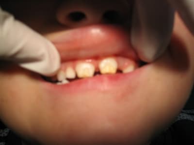 127 2741 zsn30b - Eugenol