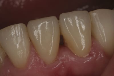 12 mois sjso23 - Eugenol