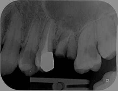 1438 x 20170722 091716 xabe4yvdx9qz 4 rdyi2v - Eugenol