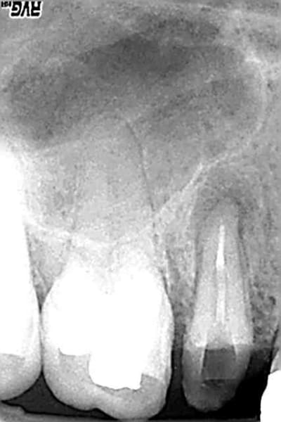 15 d mont e dxo72e - Eugenol