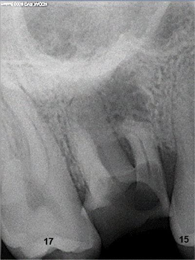 16 rx ozh60s - Eugenol