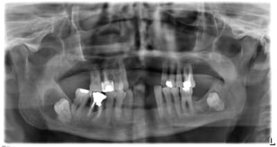 17 9 10 x5wqqt - Eugenol