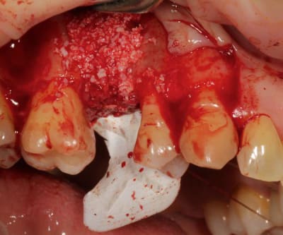 1853 10151469282613909 1015929230 n hhsfft - Eugenol