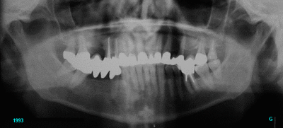 1984 1993 ltxmma - Eugenol