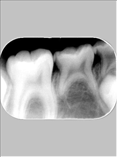 1999 timrgz - Eugenol