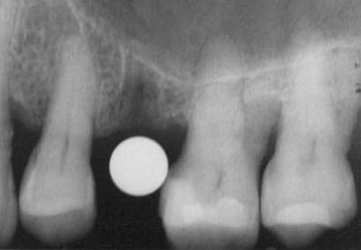 19 crpays - Eugenol