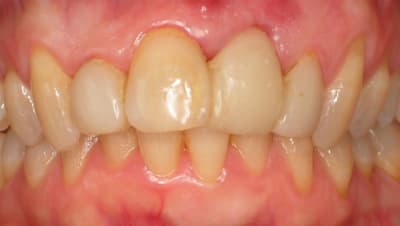 1  large  tjgmkl - Eugenol