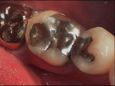 1 bmgapc - Eugenol