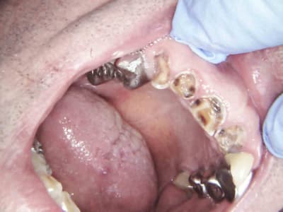1 qpddxk - Eugenol