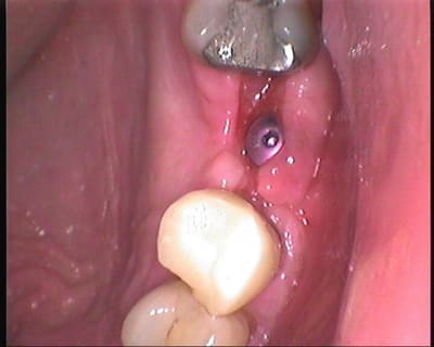 1 srvufi - Eugenol