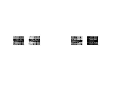 1 xump3z - Eugenol