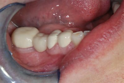 2007 09 10 004 bc5cuw - Eugenol