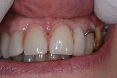 2008 01 25 009 mxrc4g - Eugenol