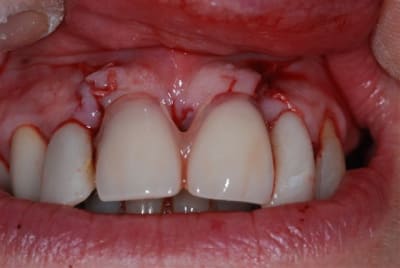 2008 01 25 018 d04q9x - Eugenol