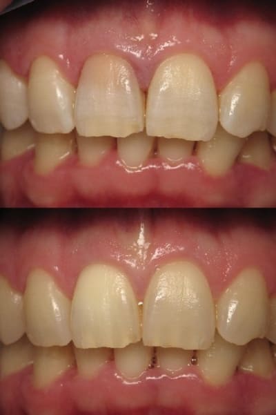 20080114à18 sugowx - Eugenol