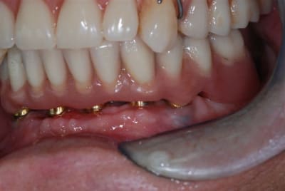 2009 07 12 003 bwm9bd - Eugenol