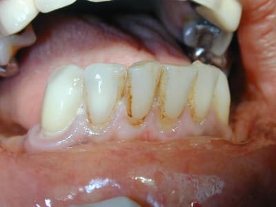 2009 11 20  4  s6oexp - Eugenol