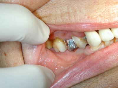 2009 11 20  6  lmeffq - Eugenol