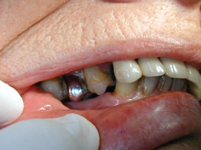 2009 11 27  6  tnp5ws - Eugenol