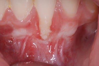 2010 09 30 001 naradp - Eugenol