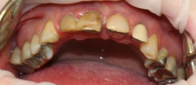 2010 04 16 0069c hcrjld - Eugenol