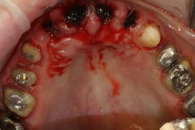 2010 04 16 0073 aicsda - Eugenol