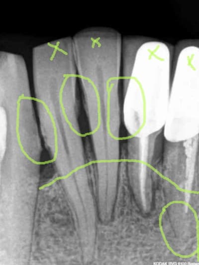 2011 06 21 220853 ilq7ka - Eugenol