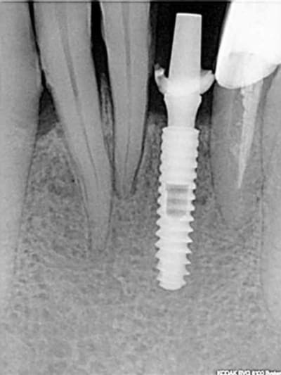 2011 10 23 094712 h8ac2u - Eugenol