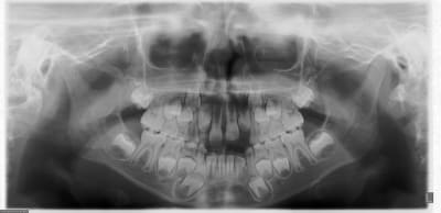 20111024 1 1 - Eugenol