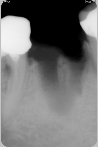 2011b mmg3dl - Eugenol