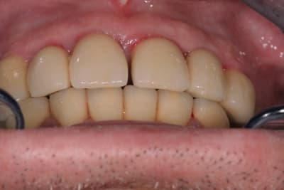 2012 04 18 08 44 32 zmdeny - Eugenol