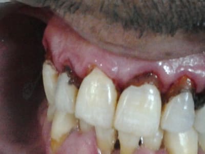 2012 05 29 13.46 - Eugenol