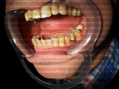 20121210 103948 kiqqa2 - Eugenol