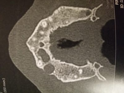 20140401 204406 omhfc3 - Eugenol